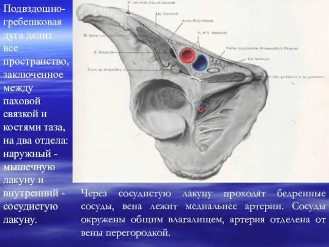 Подвздошно-гребешковая дуга делит все пространство, заключенное между паховой связкой и костями