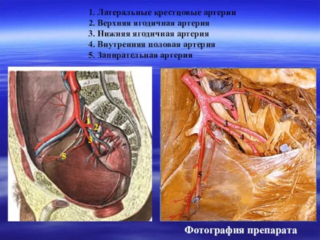 1. Латеральные крестцовые артерии 2. Верхняя ягодичная артерия 3. Нижняя ягодичная