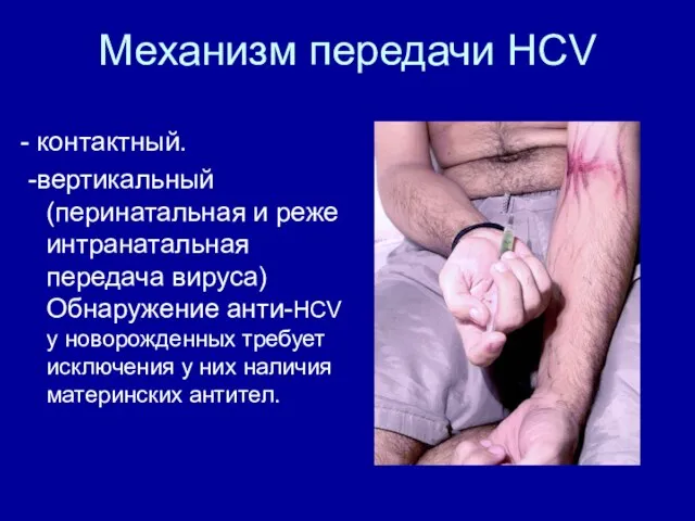 Механизм передачи HCV - контактный. -вертикальный (перинатальная и реже интранатальная передача