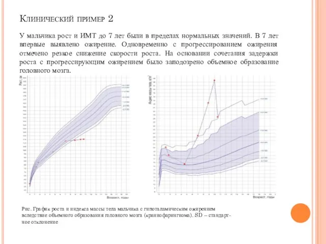 Клинический пример 2 У мальчика рост и ИМТ до 7 лет