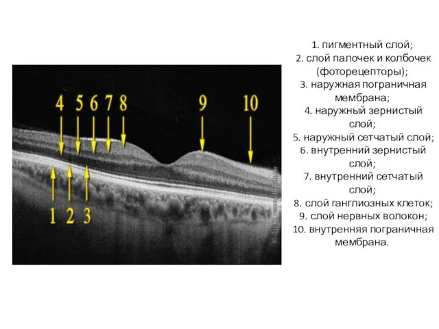 1. пигментный слой; 2. слой палочек и колбочек (фоторецепторы); 3. наружная