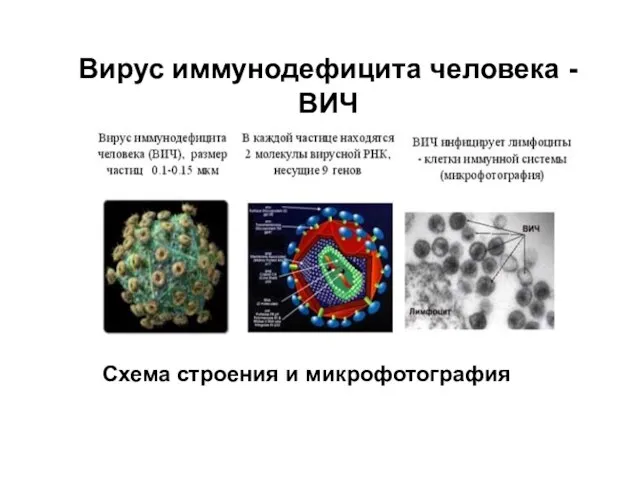 Вирус иммунодефицита человека - ВИЧ Схема строения и микрофотография