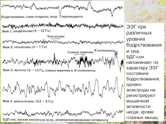 ЭЭГ при различных уровнях бодрствования и сна. БДГ-сон напоминает по характеру