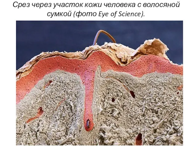 Срез через участок кожи человека с волосяной сумкой (фото Eye of Science).