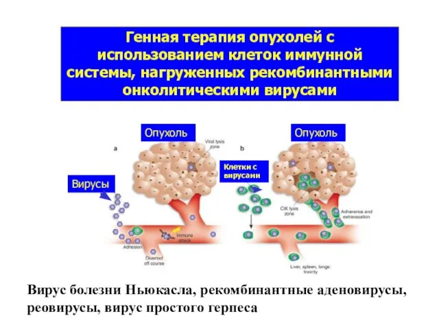 Генная терапия опухолей с использованием клеток иммунной системы, нагруженных рекомбинантными онколитическими