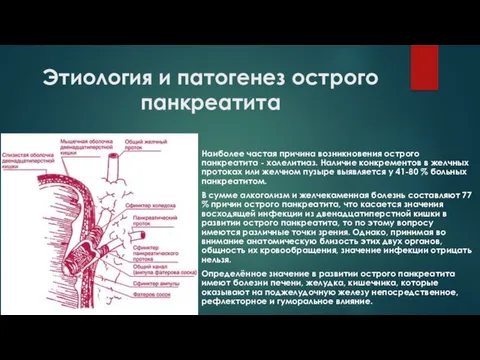 Этиология и патогенез острого панкреатита Наиболее частая причина возникновения острого панкреатита