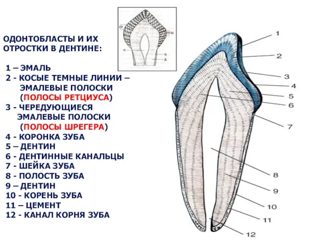 ОДОНТОБЛАСТЫ И ИХ ОТРОСТКИ В ДЕНТИНЕ: 1 – ЭМАЛЬ 2 -