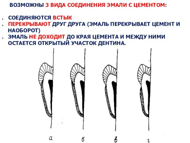 ВОЗМОЖНЫ 3 ВИДА СОЕДИНЕНИЯ ЭМАЛИ С ЦЕМЕНТОМ: . СОЕДИНЯЮТСЯ ВСТЫК .