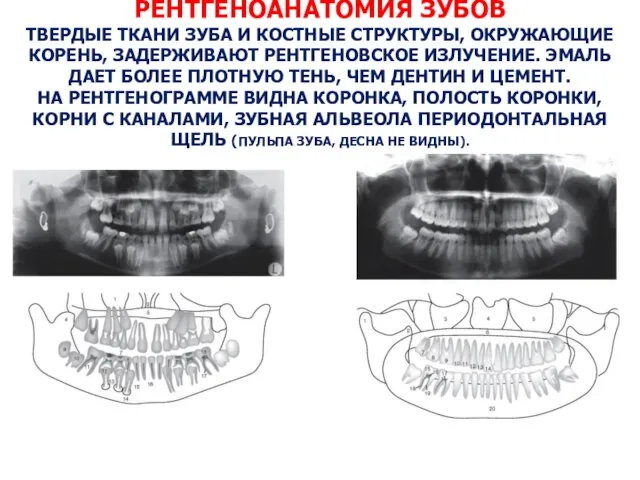 РЕНТГЕНОАНАТОМИЯ ЗУБОВ ТВЕРДЫЕ ТКАНИ ЗУБА И КОСТНЫЕ СТРУКТУРЫ, ОКРУЖАЮЩИЕ КОРЕНЬ, ЗАДЕРЖИВАЮТ