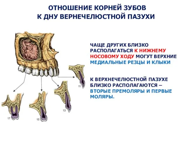 ОТНОШЕНИЕ КОРНЕЙ ЗУБОВ К ДНУ ВЕРНЕЧЕЛЮСТНОЙ ПАЗУХИ ЧАЩЕ ДРУГИХ БЛИЗКО РАСПОЛАГАТЬСЯ