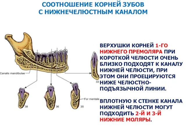 ВЕРХУШКИ КОРНЕЙ 1-ГО НИЖНЕГО ПРЕМОЛЯРА ПРИ КОРОТКОЙ ЧЕЛЮСТИ ОЧЕНЬ БЛИЗКО ПОДХОДЯТ