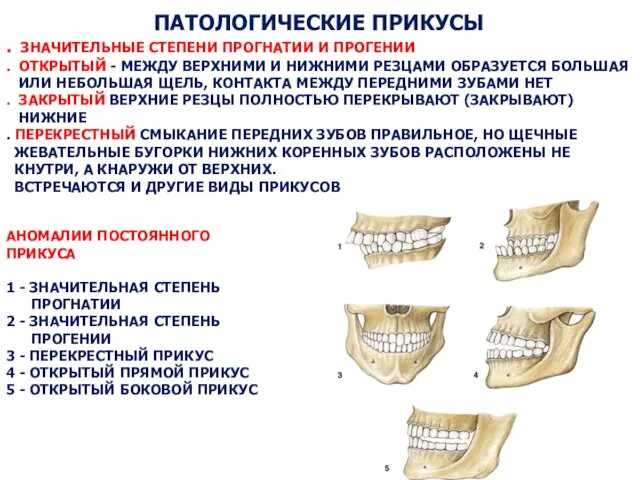 ПАТОЛОГИЧЕСКИЕ ПРИКУСЫ . ЗНАЧИТЕЛЬНЫЕ СТЕПЕНИ ПРОГНАТИИ И ПРОГЕНИИ . ОТКРЫТЫЙ -