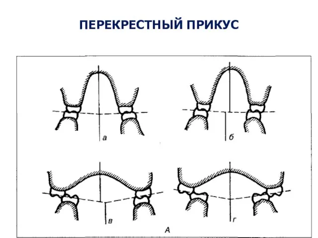 ПЕРЕКРЕСТНЫЙ ПРИКУС