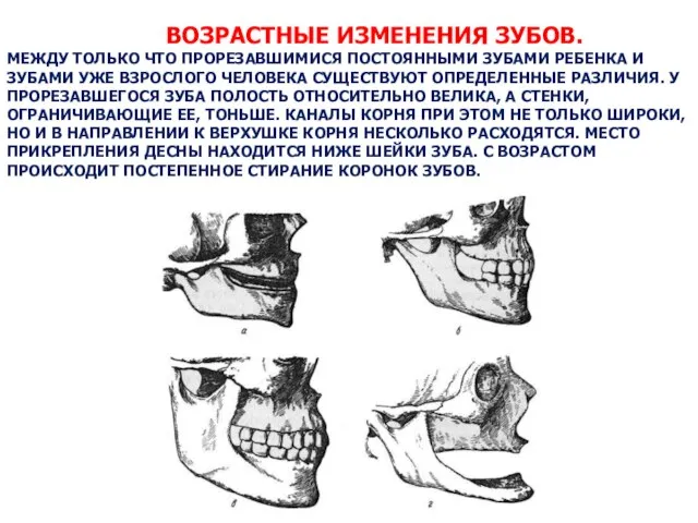 ВОЗРАСТНЫЕ ИЗМЕНЕНИЯ ЗУБОВ. МЕЖДУ ТОЛЬКО ЧТО ПРОРЕЗАВШИМИСЯ ПОСТОЯННЫМИ ЗУБАМИ РЕБЕНКА И