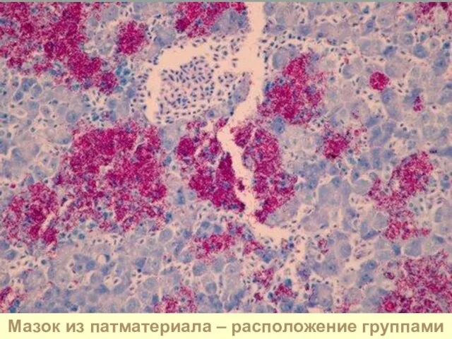 Мазок из патматериала – расположение группами