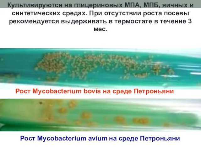 Культивируются на глицериновых МПА, МПБ, яичных и синтетических средах. При отсутствии