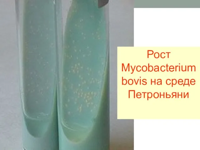 Рост Mycobacterium bovis на среде Петроньяни