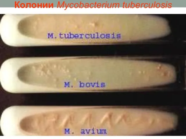 Колонии Mycobacterium tuberculosis