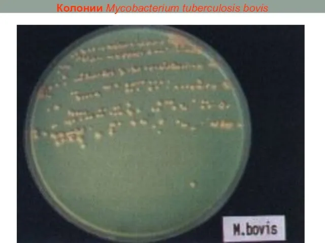 Колонии Mycobacterium tuberculosis bovis