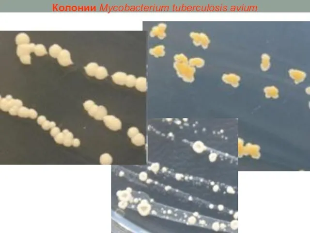 Колонии Mycobacterium tuberculosis avium