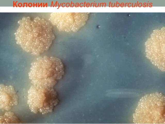 Колонии Mycobacterium tuberculosis