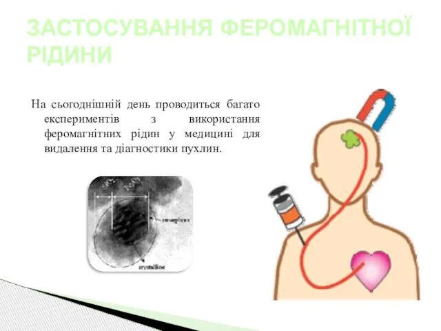 Медицина На сьогоднішній день проводиться багато експериментів з використання феромагнітних рідин