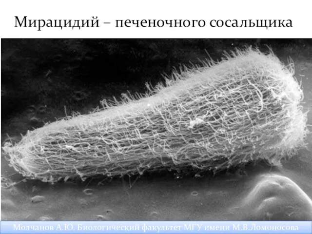 Мирацидий – печеночного сосальщика Молчанов А.Ю. Биологический факультет МГУ имени М.В.Ломоносова