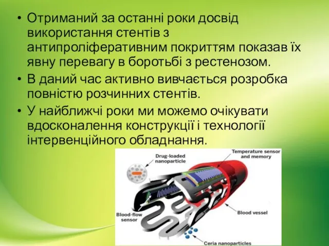 Отриманий за останні роки досвід використання стентів з антипроліферативним покриттям показав