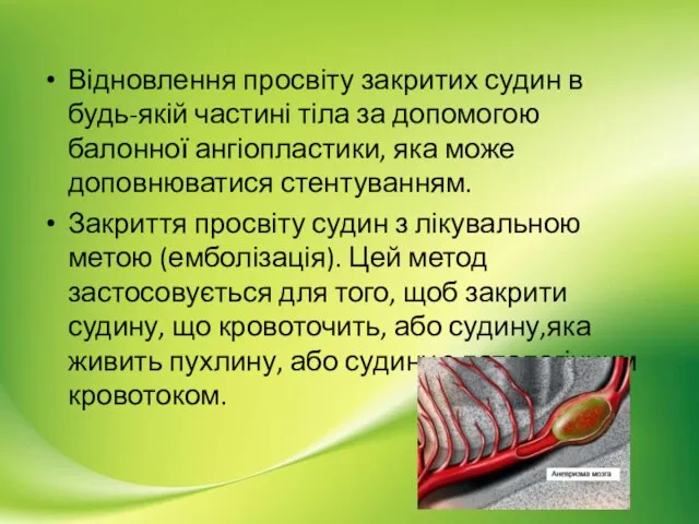 Відновлення просвіту закритих судин в будь-якій частині тіла за допомогою балонної