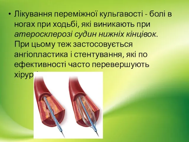 Лікування переміжної кульгавості - болі в ногах при ходьбі, які виникають