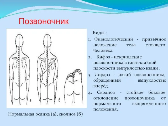 Позвоночник Виды : 1. Физиологический - привычное положение тела стоящего человека.