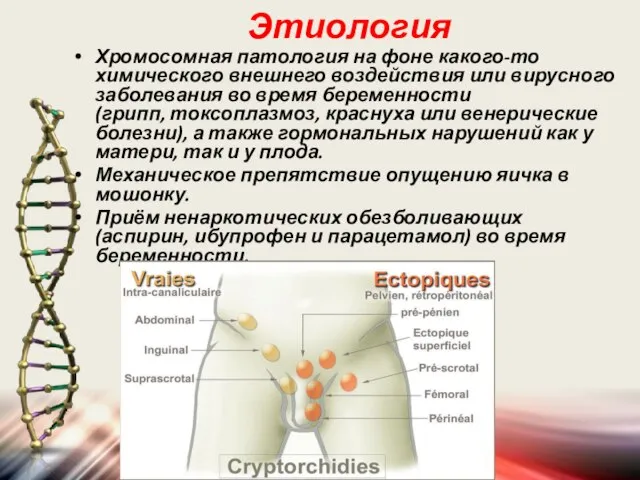 Этиология Хромосомная патология на фоне какого-то химического внешнего воздействия или вирусного