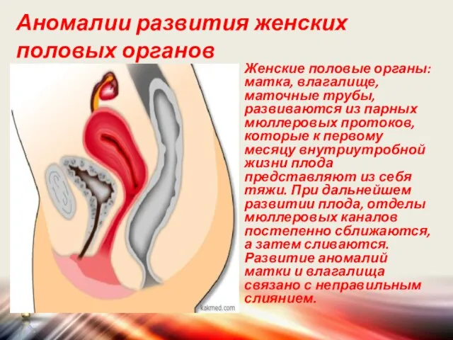 Аномалии развития женских половых органов Женские половые органы: матка, влагалище, маточные