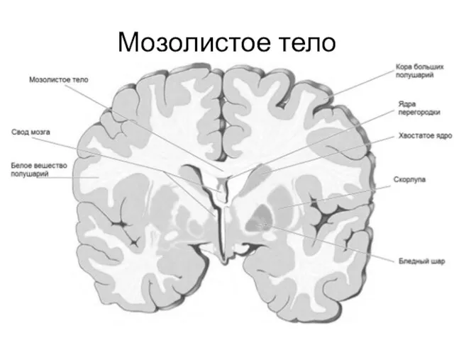 Мозолистое тело