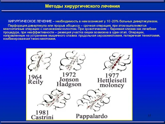 ХИРУРГИЧЕСКОЕ ЛЕЧЕНИЕ – необходимость в нем возникает у 10 -20% больных