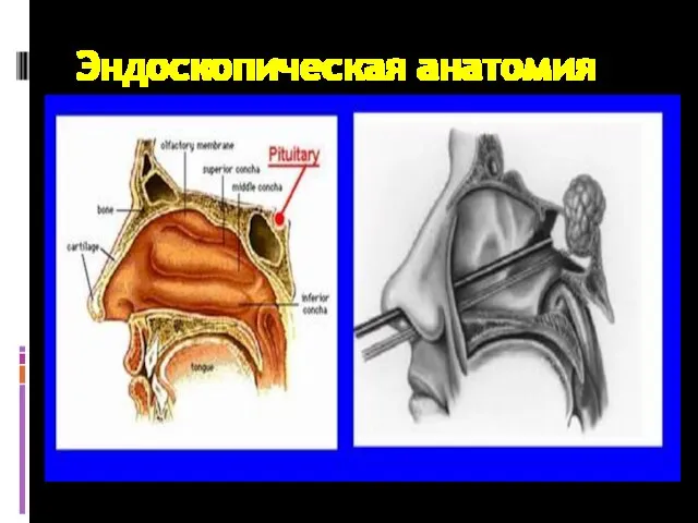 Эндоскопическая анатомия