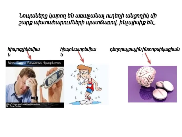 Նոպաները կարող են առաջանալ ուղեղի անցողիկ մի շարք ախտահարումների պատճառով, ինչպիսիք են,, դեղորայքային հիպոգլիկեմիան հիպոնատրեմիան ինտոքսիկացիան: