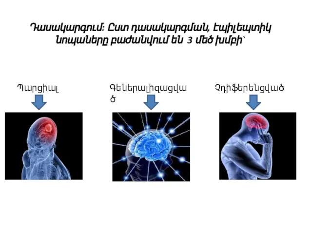 Դասակարգում: Ըստ դասակարգման, էպիլեպտիկ նոպաները բաժանվում են 3 մեծ խմբի` Գեներալիզացված Չդիֆերենցված Պարցիալ