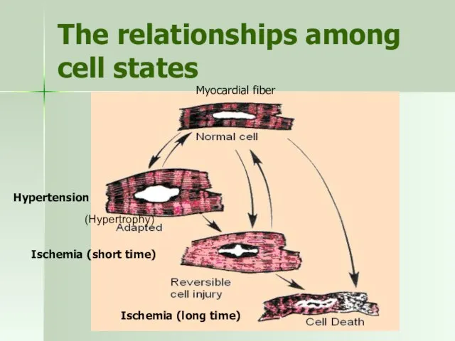 The relationships among cell states (Hypertrophy) Myocardial fiber Hypertension Ischemia (short time) Ischemia (long time)