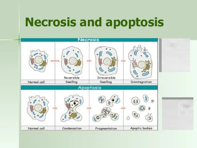 Necrosis and apoptosis