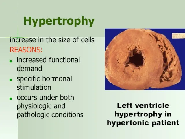 Hypertrophy increase in the size of cells REASONS: increased functional demand