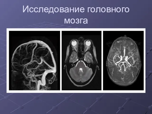 Исследование головного мозга