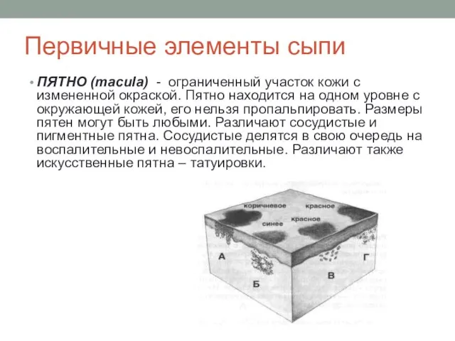 Первичные элементы сыпи ПЯТНО (macula) - ограниченный участок кожи с измененной