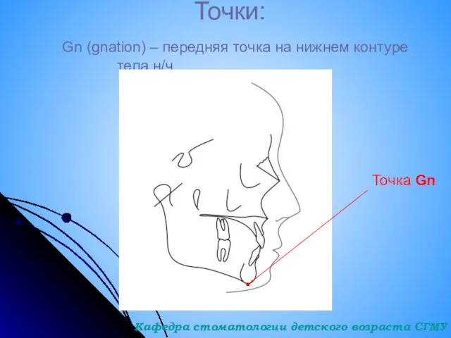 Точки: Gn (gnation) – передняя точка на нижнем контуре тела н/ч