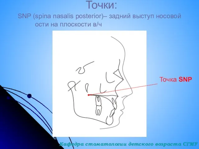 Точки: SNP (spina nasalis posterior)– задний выступ носовой ости на плоскости