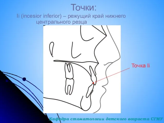 Точки: Ii (incesior inferior) – режущий край нижнего центрального резца Точка