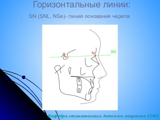 Горизонтальные линии: S N SN (SNL, NSe)- линия основания черепа SN Кафедра стоматологии детского возраста СГМУ