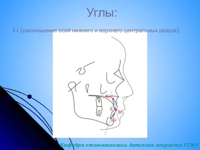 Углы: I-i (соотношение осей нижнего и верхнего центральных резцов) Ais Is