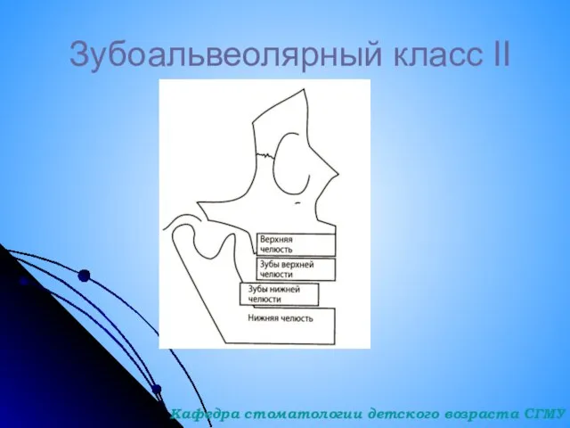 Зубоальвеолярный класс II Кафедра стоматологии детского возраста СГМУ