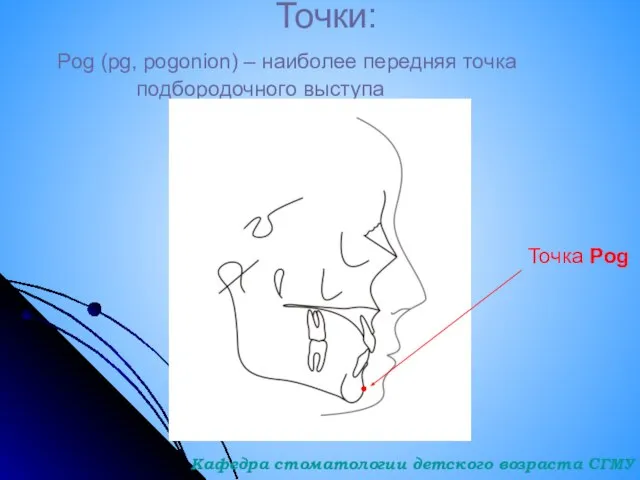 Точки: Pog (pg, pogonion) – наиболее передняя точка подбородочного выступа Точка